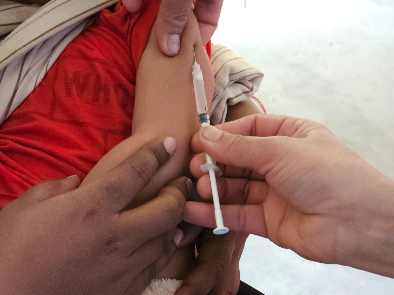 Rougeole en France et au Maroc : le retour d'un virus qu'on croyait maîtrisé
